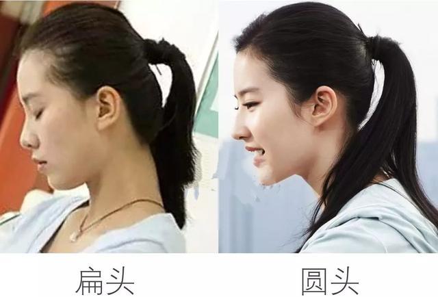 你的育儿经：扁头是福相？科学证明：扁头影响的可不止是宝宝美观，家长要知道