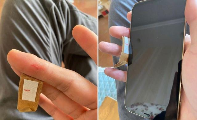iPhone12直角边框太锋利，果粉集体晒图，手指被割流血