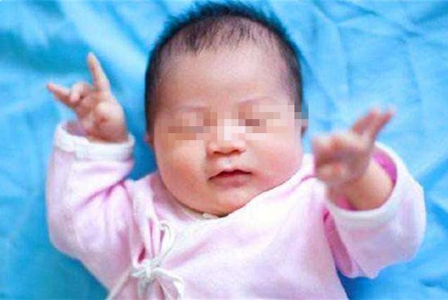 梦的色彩|为什么有的孩子一出生头发就浓密，有的却很稀疏？原因无非这3点