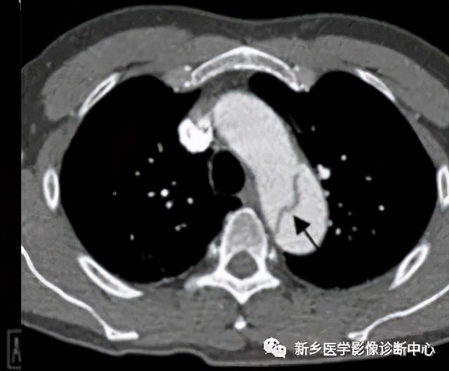 夜间值班腹部疼痛原因影像表现，值得收藏