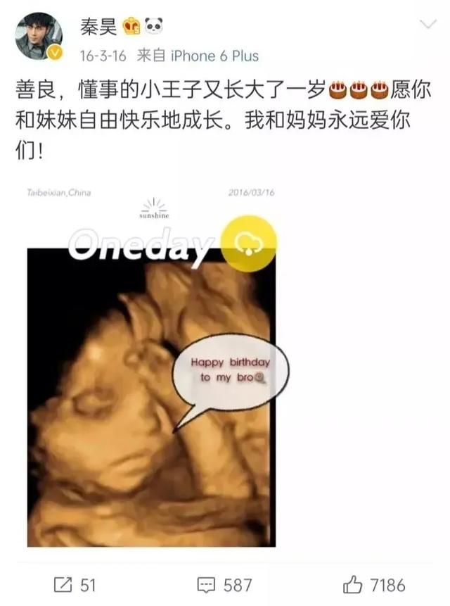 「你的育儿经」为什么E10四维彩超受到更多妈妈青睐？看完就知道了
