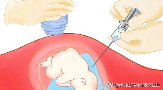 「你的育儿经」羊水穿刺真的有那么吓人吗？