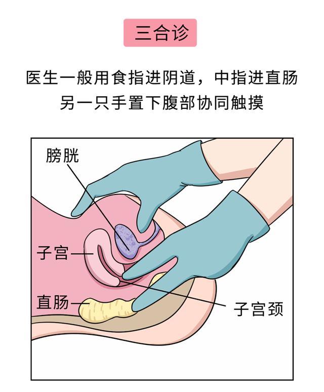 未婚少女能做妇科检查吗？那层膜会不会破？建议看一看