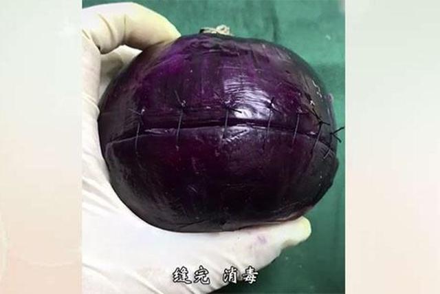 「画说育儿」网友给“洋葱”做剖宫产手术，过来人：又疼了一次！