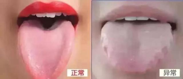 身体好不好，看“脸”就知道！有这些变化的人要小心