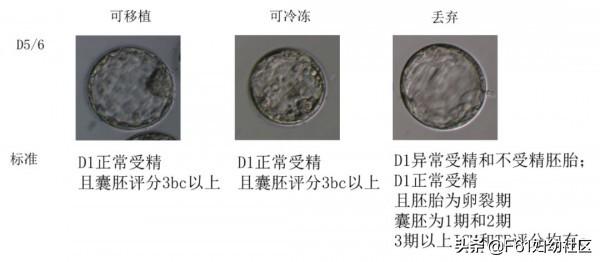 生活矜持点|试管婴儿胚胎评分和胚胎移植、冷冻、丢弃标准