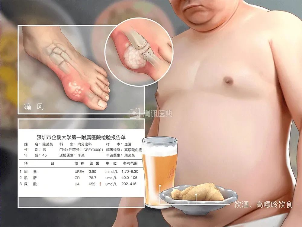 痛风|饮料炸鸡使劲造？12岁男孩被送医！这病很常见，千万小心