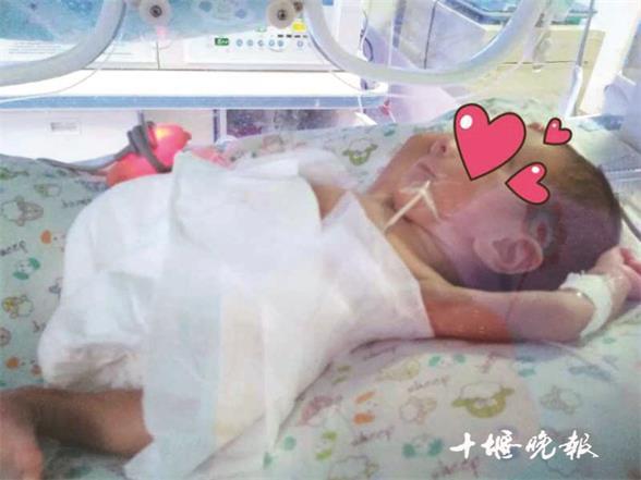 『超级宝妈』【十堰】胎龄30周，体重950克！上月出生的“巴掌公主”满月了！