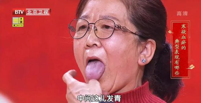 活血|血瘀也分寒热，切勿盲目化瘀！三杯代茶饮，凉血化瘀，血管畅通