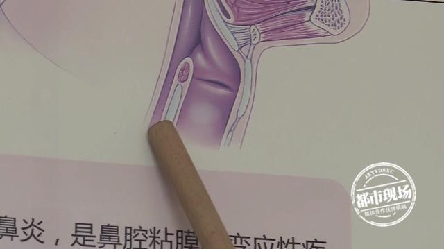 「超级宝妈」3岁女童天天掏鼻孔,嘴里“吐出”异物,妈妈:她想当豌豆射手