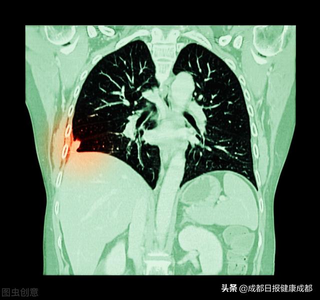 检查|如何选择医学影像检查？影像科医生来教你