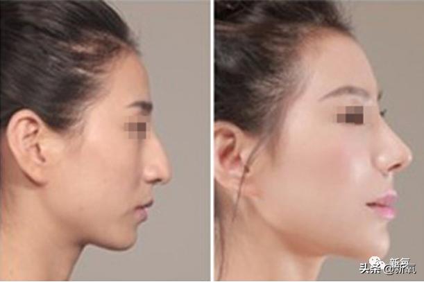 为什么95年的虞书欣一个素颜就老成这样|资讯早知道