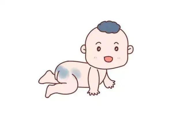家有儿女|宝宝屁屁上的青斑能消退吗？