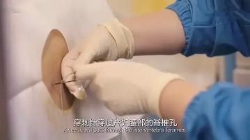 超级宝妈|生孩子，你会选择打无痛吗？到底怎么打的？一组图看完太直观了