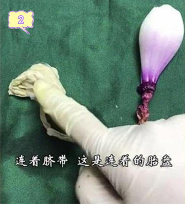 【你的育儿经】网友用洋葱模拟生娃全过程，过来人：看着就疼，你准备好了吗
