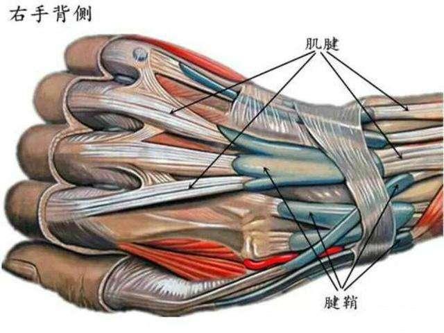 抽吸|手腕上长个大包？医生告诉你：腱鞘囊肿除了手术切，还能怎么治？