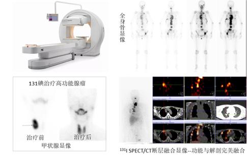 揭开核医学的神秘面纱