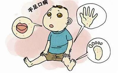 你的育儿经|爱“吃手”险酿惨剧！珠海一岁婴儿突然全身抽搐发黑！手足口病已进入高发期！