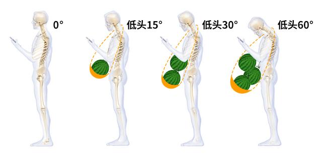 低头看手机，等于头顶30斤的西瓜，这哪里还吃得消