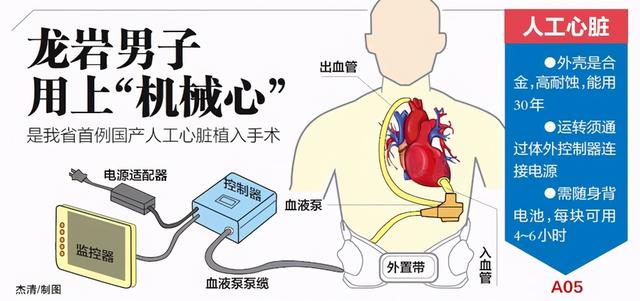 心脏|救命神器！纯国产！免费