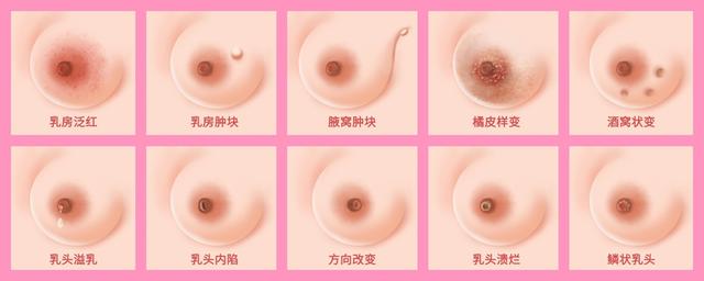 既切肿瘤又保乳房！乳腔镜为何未普及？医生说出原因