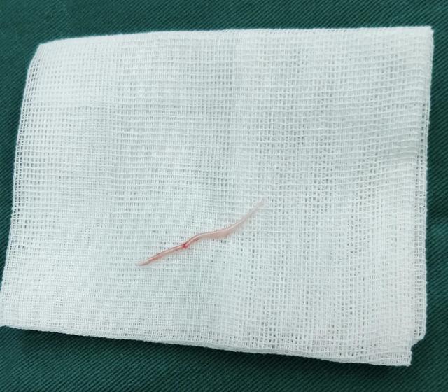 主动脉|10个科室30位专家参与大抢救，就因为一根鱼刺