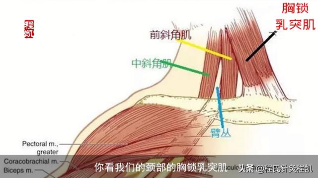 程凯养生说：缓解“颈肩不适”的穴位，很多人都不知道