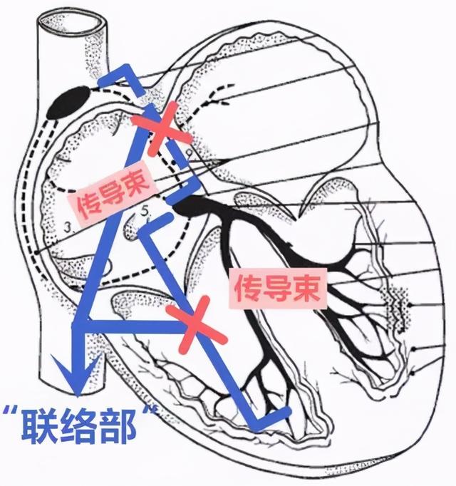 心跳慢到底要不要紧？