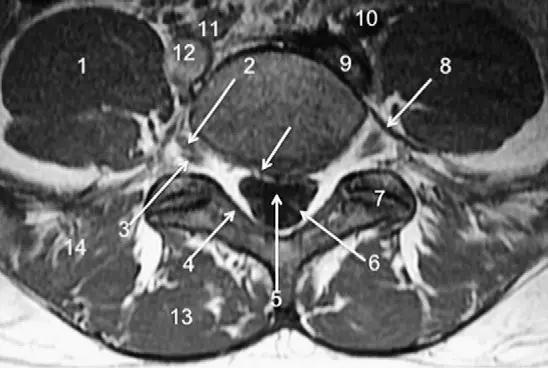 ռ׵ MRI ͼ