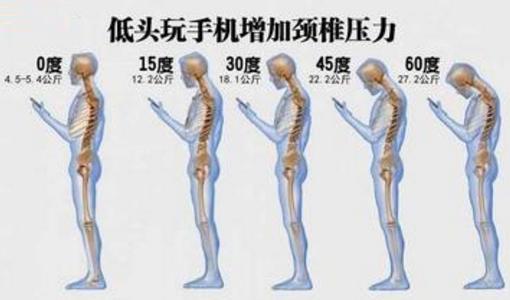 男孩“落枕”，一波操作后竟差点瘫痪！医生提醒：千万别乱按