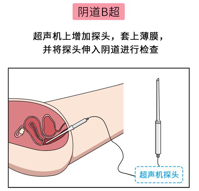 未婚少女能做妇科检查吗？那层膜会不会破？建议看一看