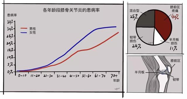 膝关节一活动，时不时传来“咔咔咔”的响声，需要治疗吗？