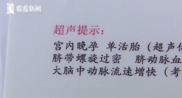 #超级宝妈#女子怀胎8个月肚里突然没了动静 医生一查惊呆:30多圈啊