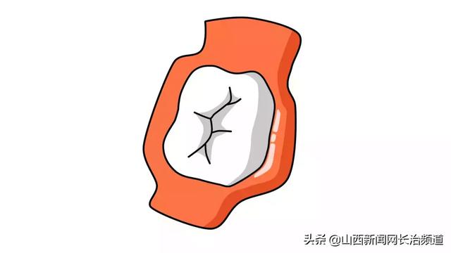 超级宝妈|长兴口腔六一儿童节福利，快带孩子来免费做窝沟封闭吧