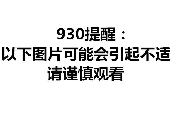 毒蛇|广西男孩全身出现多处瘀斑被送ICU！事后才知道…