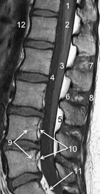 ռ׵ MRI ͼ