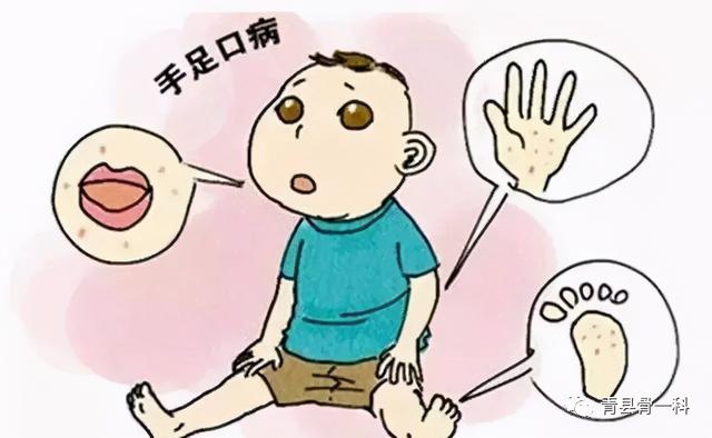 什么是手足口病？孩子出现了这些个症状，或许它就是祸根