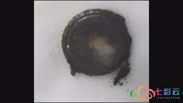 环球网|家长注意！玉溪多名儿童误食这种东西，险些夺命！B超触目惊心…