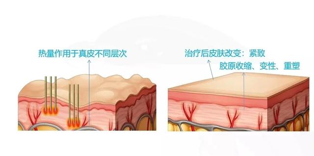 「你的育儿经」坚持抹橄榄油就能祛除妊娠纹？别逗了