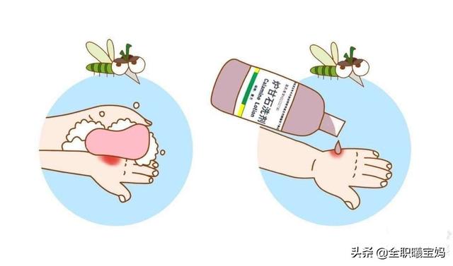 相亲相爱|宝宝总被蚊子叮?防蚊、止痒的正确方法,这样做!