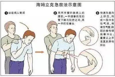 小莉|因为半颗花生米，丽水一个16个月的宝宝险丧命