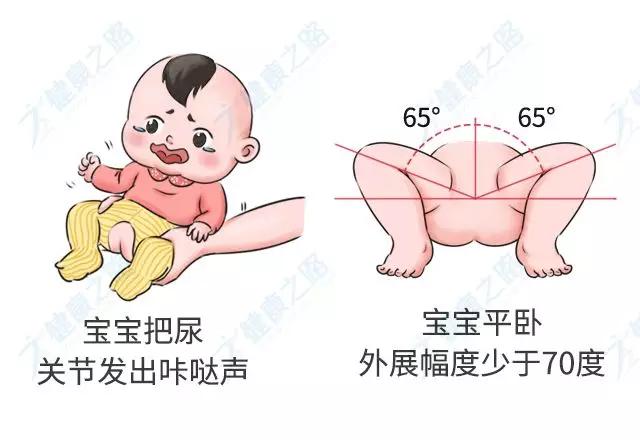 「你的育儿经」这种常见的儿童“骨骼畸形”，很多家长没发现！医生4招教你辨别