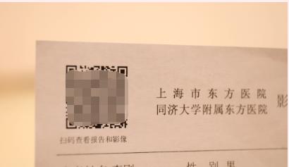 做完X线检查/CT/核磁共振后要打印胶片？打开手机扫码就行