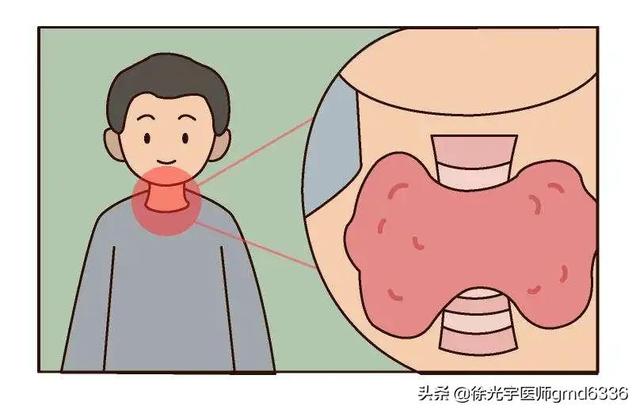 4个月结节消失，8个月炎症状全无，甲状腺结节不可怕