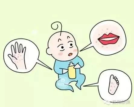 逗比大家庭|疱疹性咽峡炎又到高发期！别与手足口病、口腔溃疡搞混了