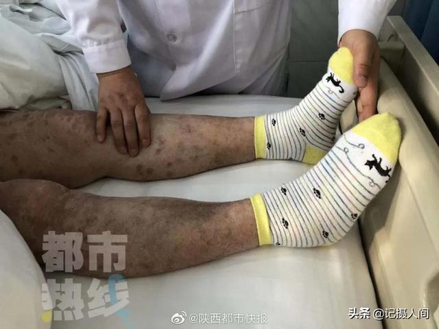 西安78岁老太危急送医，家有老人的，这件事一定要注意了……