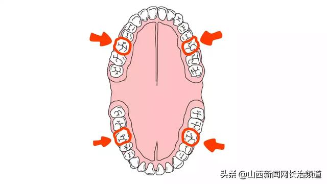 超级宝妈|长兴口腔六一儿童节福利，快带孩子来免费做窝沟封闭吧