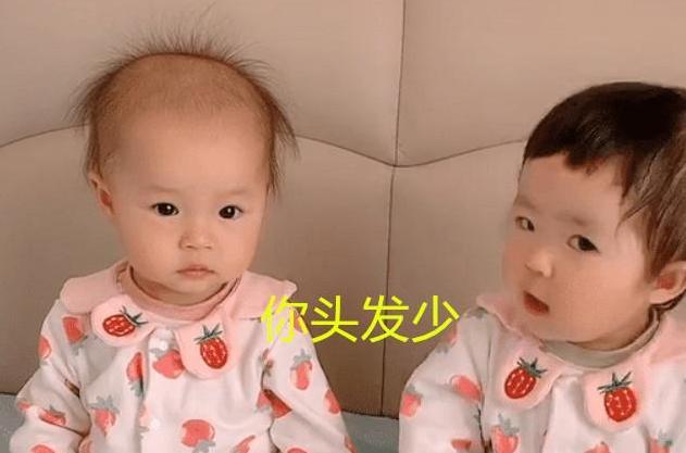你的育儿经|全网“识别度”最高双胞胎,发量一个随爹一个随妈,这差距太明显