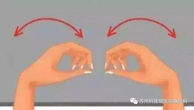 超级宝妈▲如何判断患上“妈妈手”?教你做个简单小试验