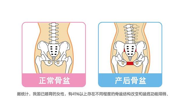 超级宝妈■女人生没生过孩子，这3个部位一眼就看出来?产后重点恢复部位！